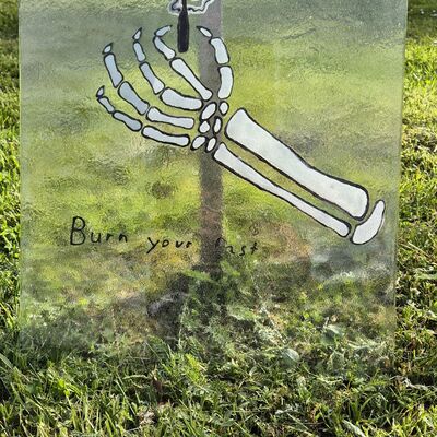 Bild vergr&ouml;&szlig;ern: Bild einer Knochenhand, gemacht von einer Sch�lerin